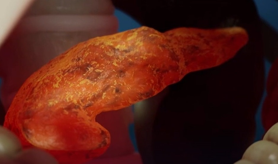 Виды оперативного лечения поджелудочной железы в Германии