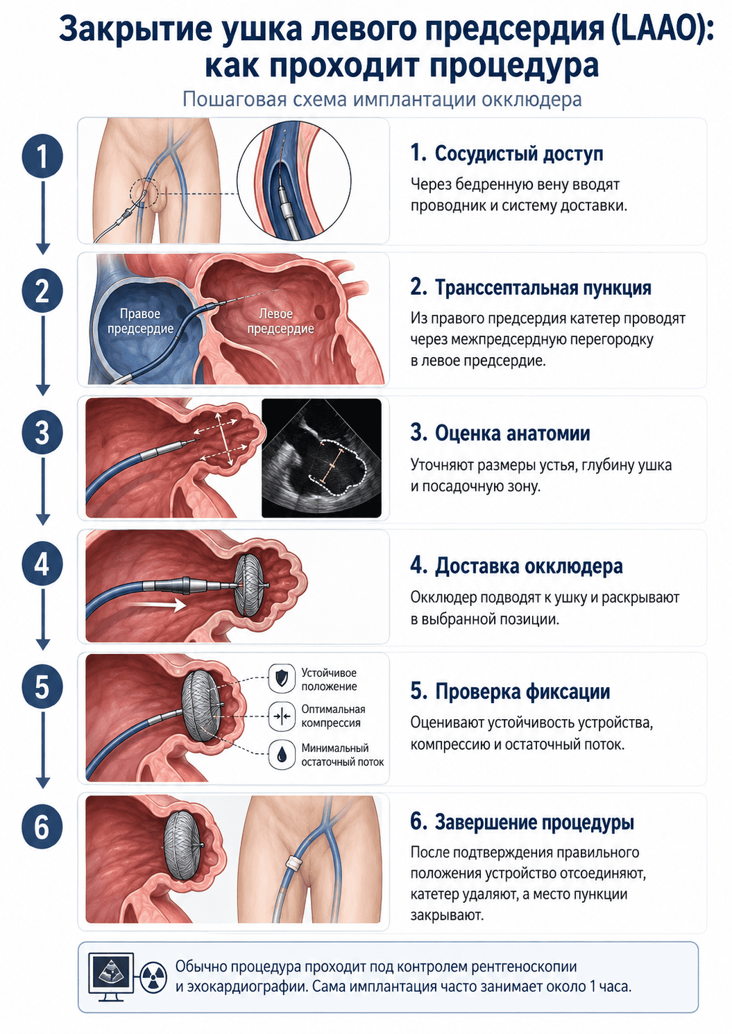Как проходит установка окклюдера: пошагово