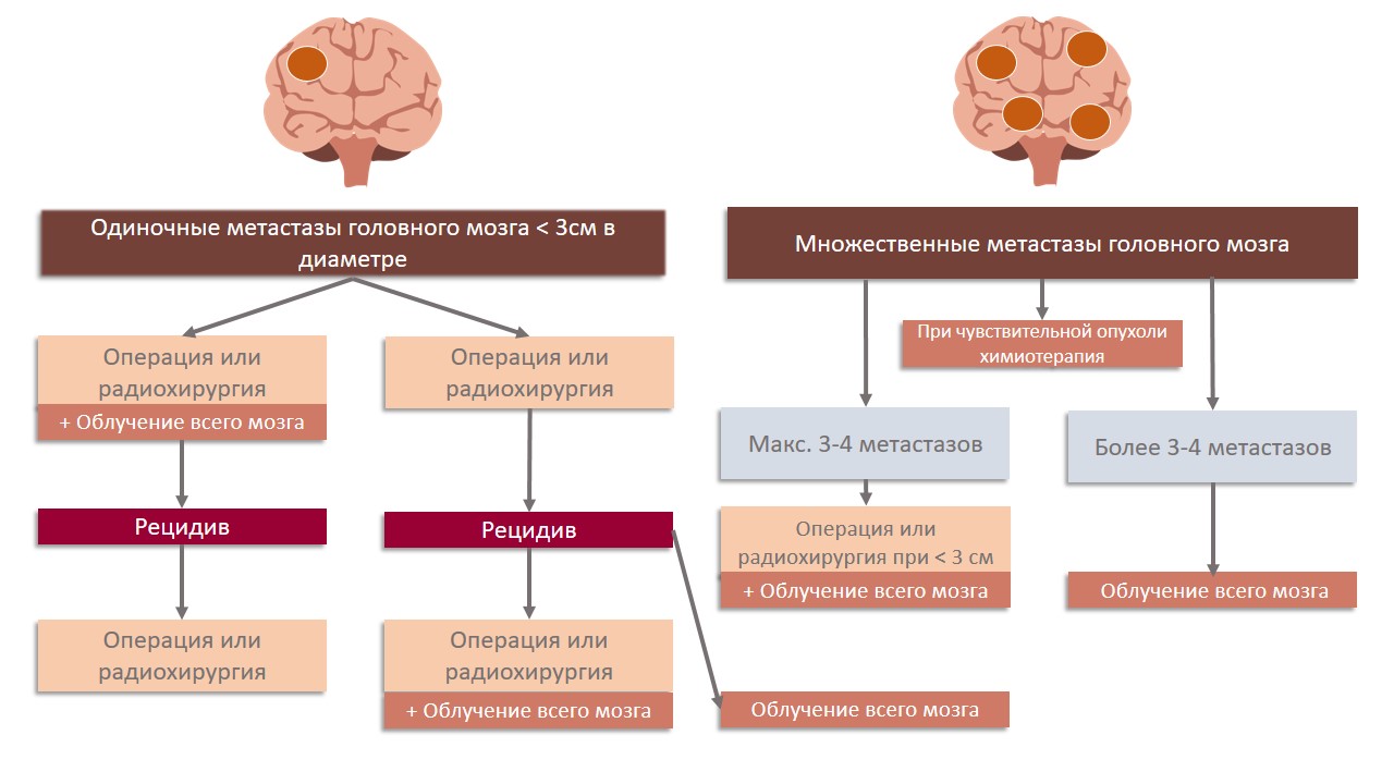 Одиночные и множественные метастазы головного мозга