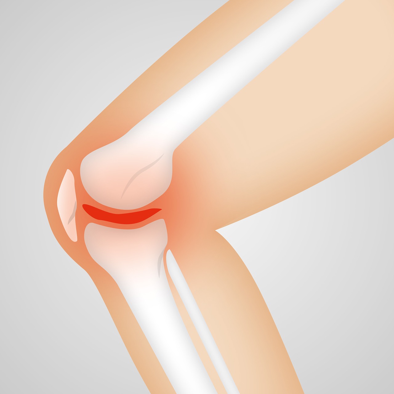 Лечение травм коленного сустава в Германии