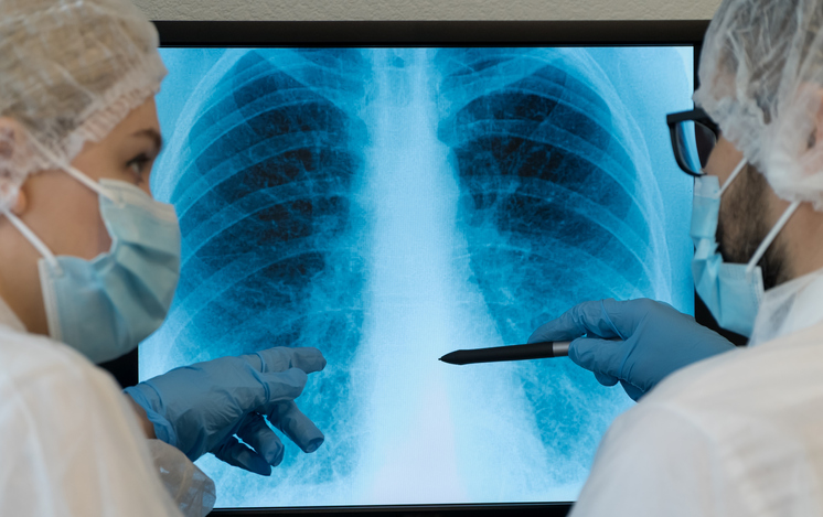 Компьютерная томография в диагностике рака легких, Германия